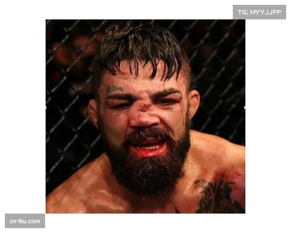 戳眼事件成UFC热门话题 持续引发广泛关注两周 戳眼事件成UFC热门话题 持续引发广泛关注两周